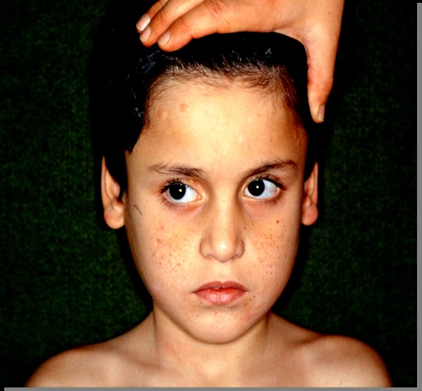 Osservazione clinica del volto